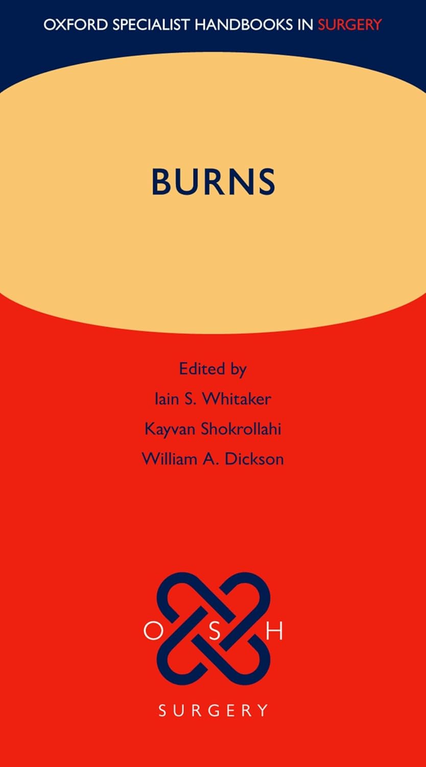 Burns