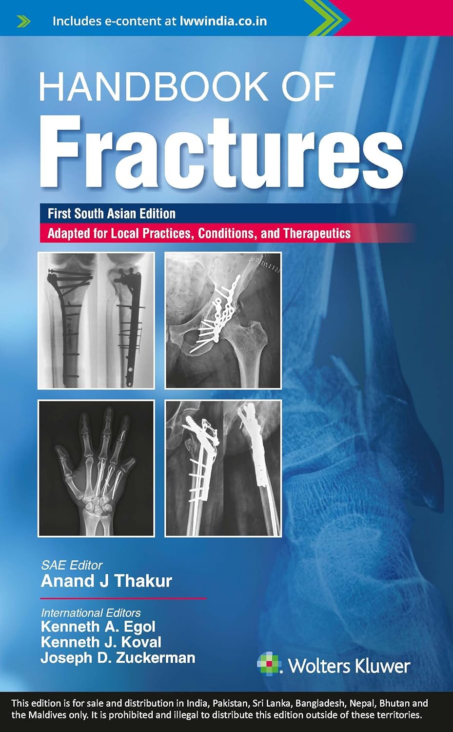 Handbook of fractures