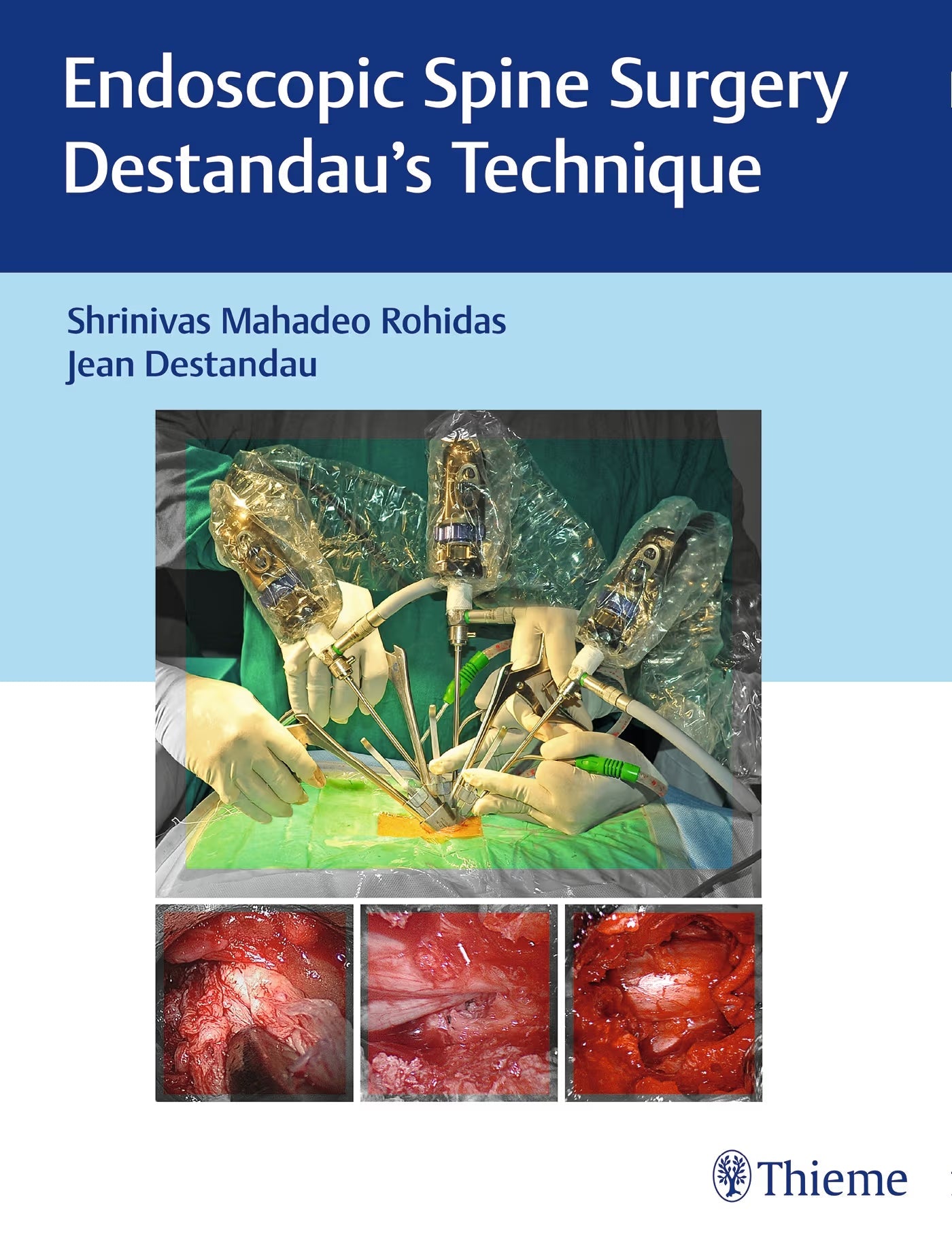 Endoscopic Spine Surgery: Destandau’s Technique 1st Edition
