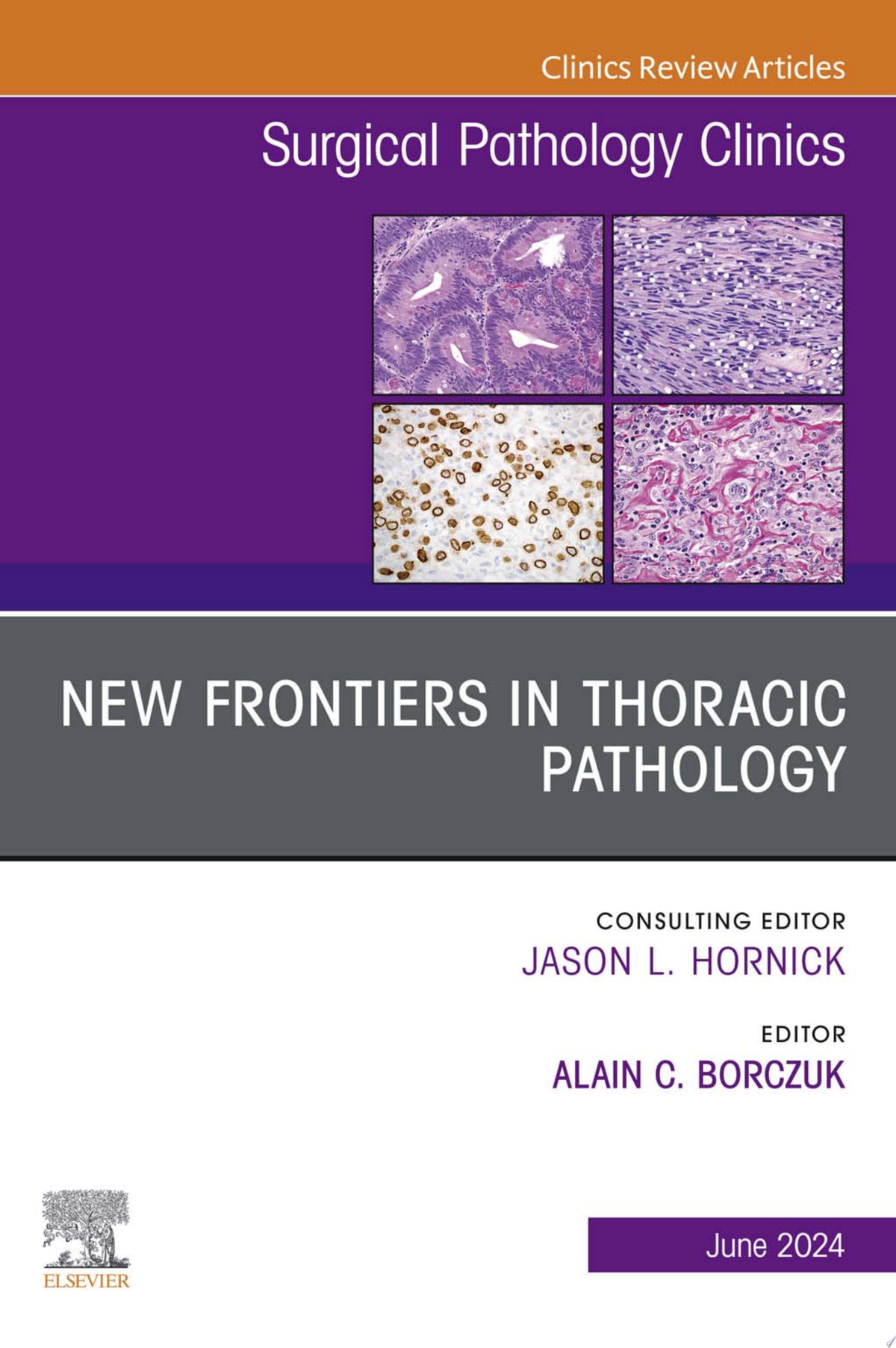 New Frontiers in Thoracic Pathology, An Issue of Surgical Pathology Clinics