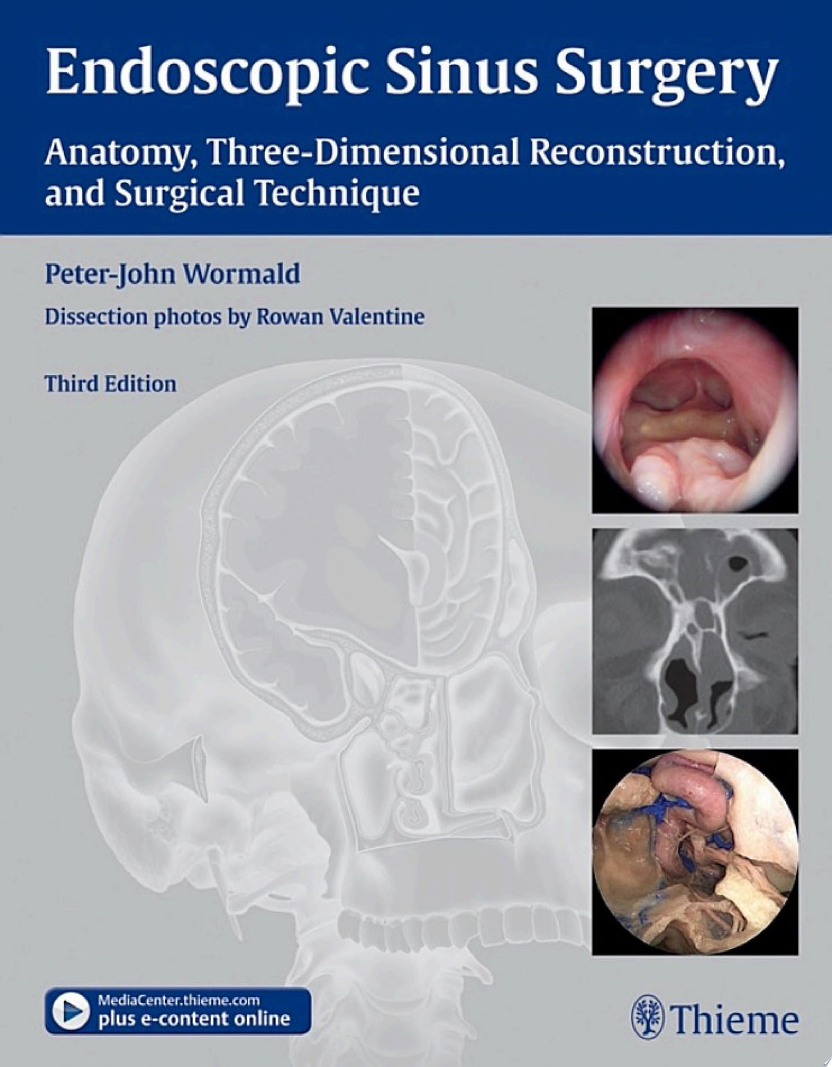 Endoscopic Sinus Surgery: Anatomy, Three-Dimensional Reconstruction, and Surgical Technique, 4th Edition