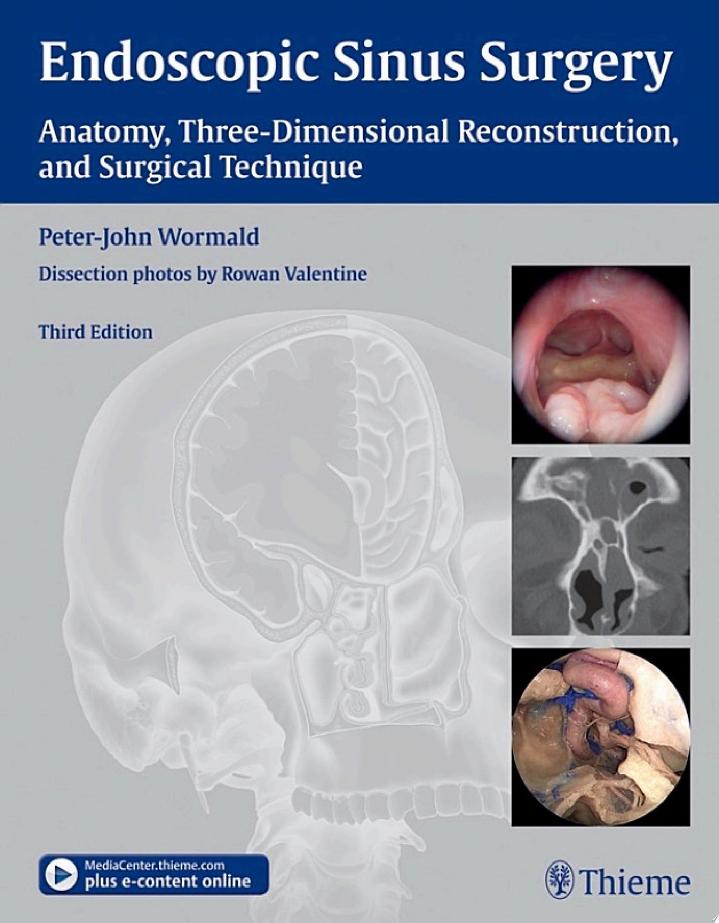 Endoscopic Sinus Surgery: Anatomy, Three-Dimensional Reconstruction, and Surgical Technique, 4th Edition