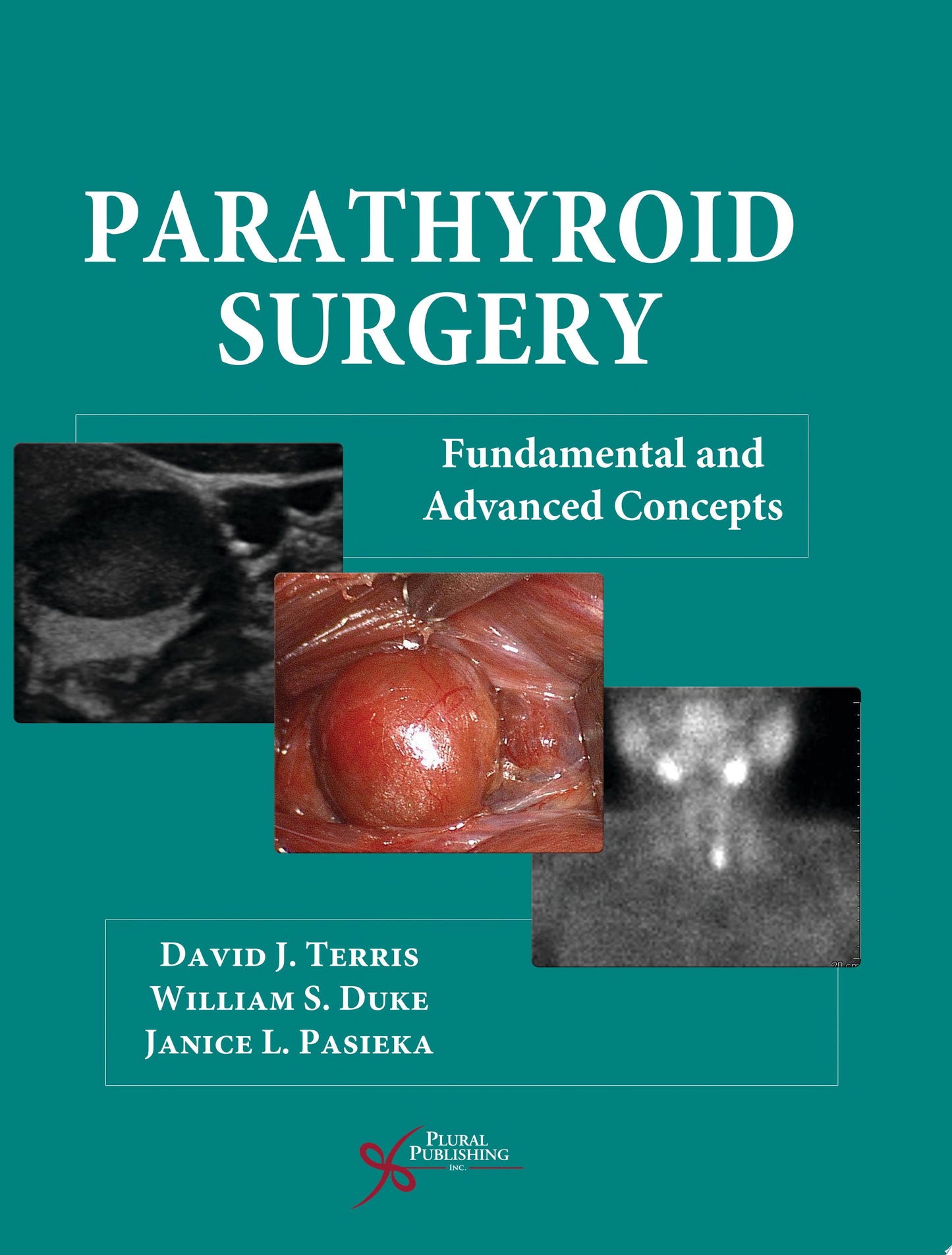 Parathyroid Surgery: Fundamental and Adavnaced Concepts