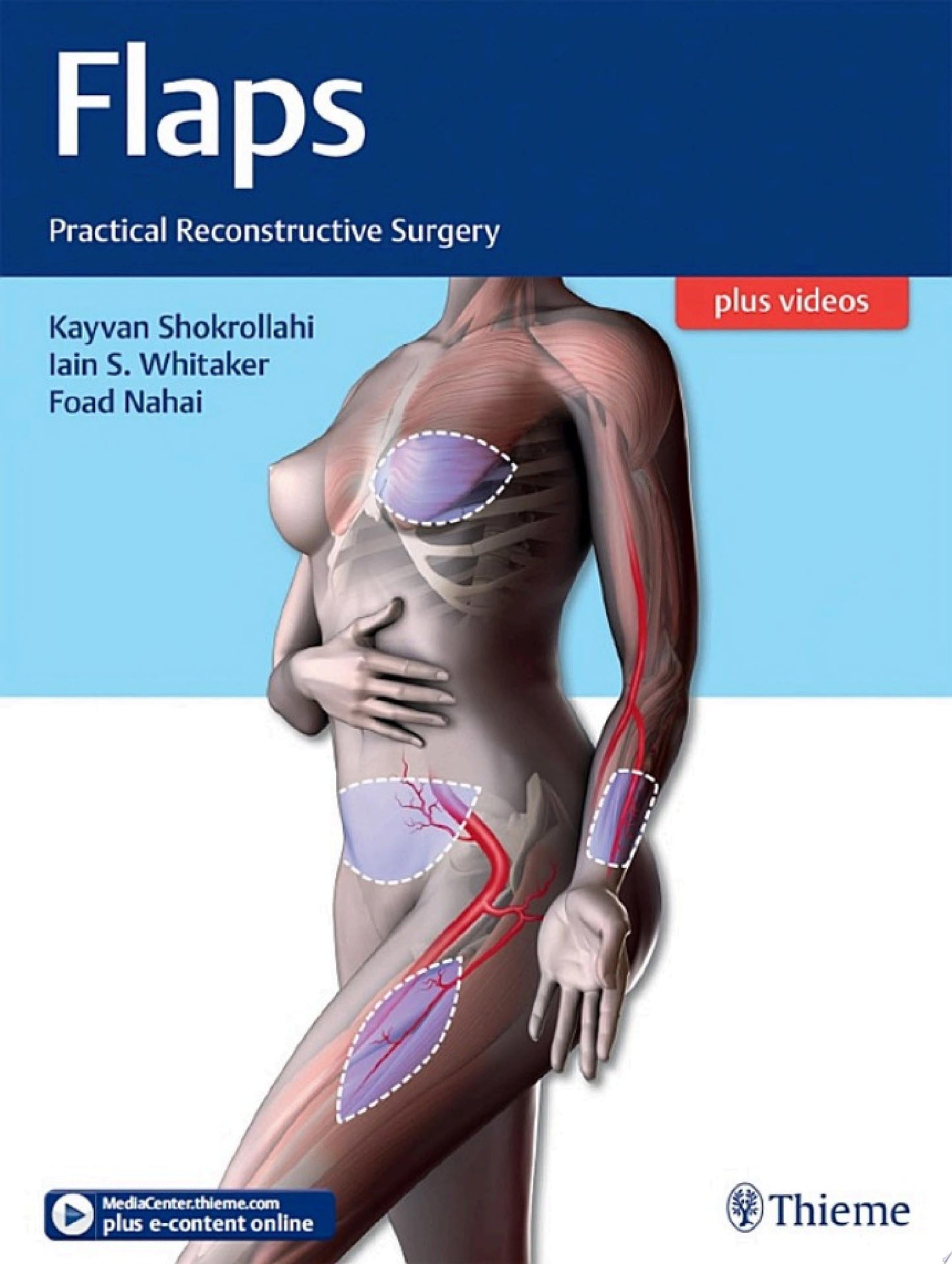 Flaps: Practical Reconstructive Surgery
