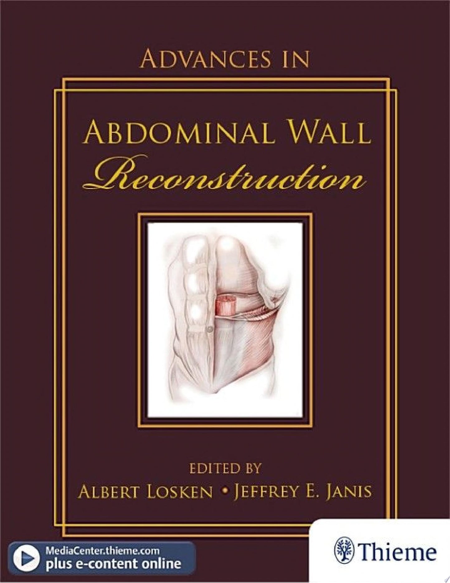Advances in Abdominal Wall Reconstruction