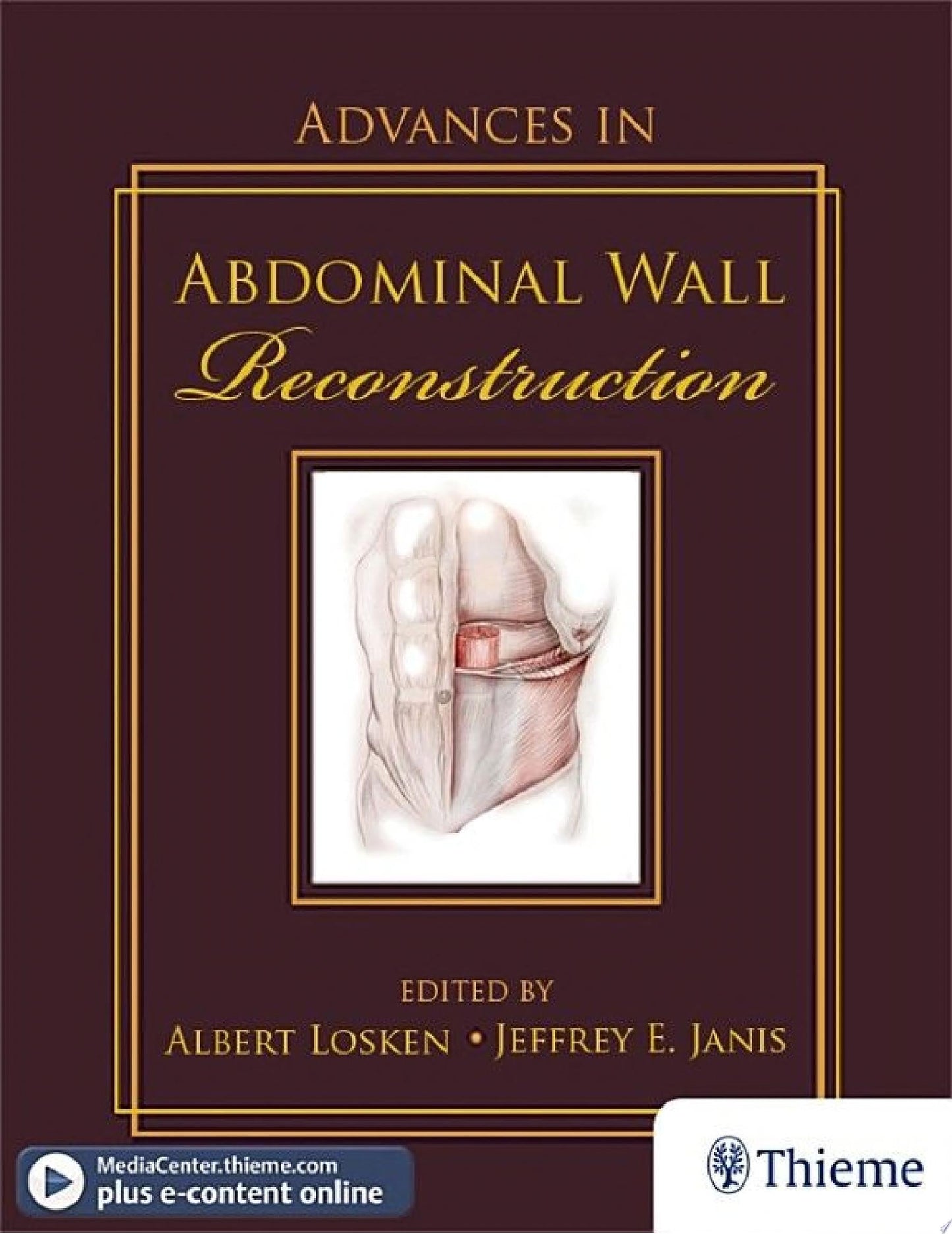 Advances in Abdominal Wall Reconstruction