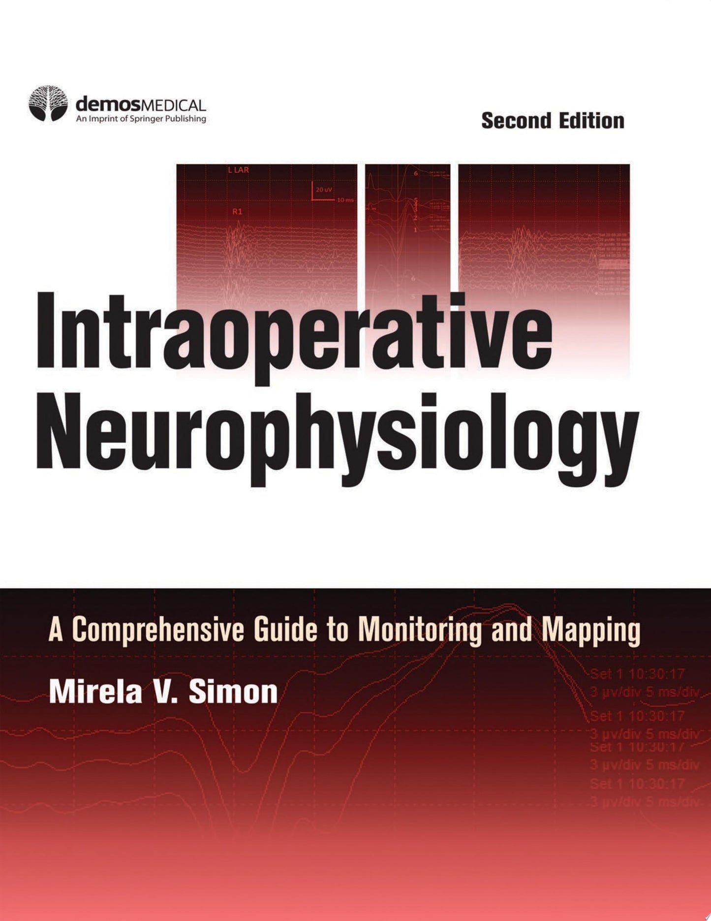 Intraoperative Neurophysiology: A Comprehensive Guide to Monitoring and Mapping