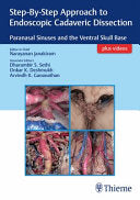 Step By Step Approach To Endoscopic Cadaveric Dissection Paranasal Sinuses And The Ventral Skull Base
