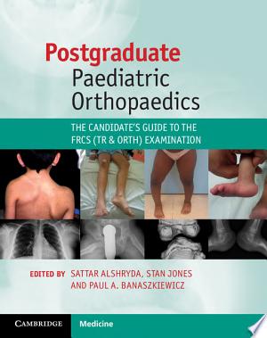 Postgraduate Paediatric Orthopaedics: The Candidate’s Guide to the FRCS Examination 2e