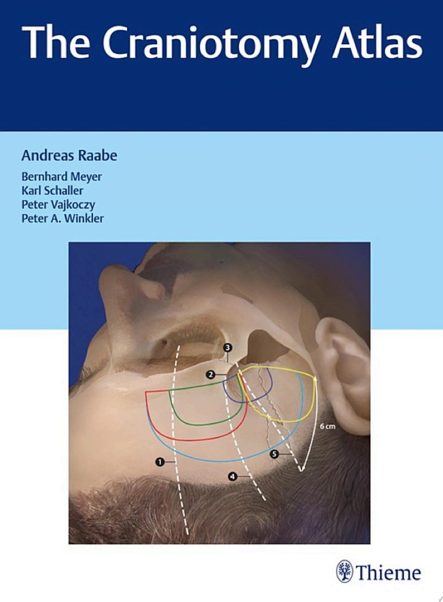 The Craniotomy Atlas