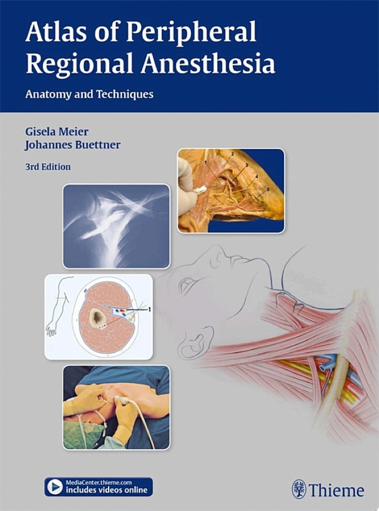 Atlas of Peripheral Regional Anesthesia: Anatomy and Techniques, 3rd Edition