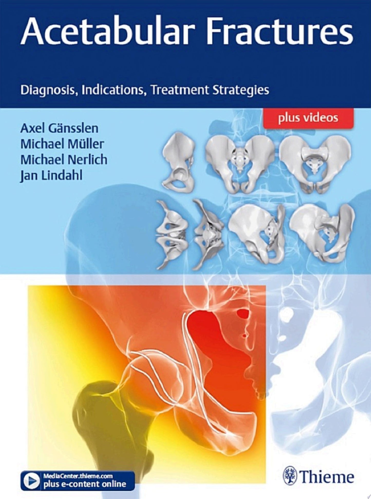 Acetabular Fractures: Diagnosis, Indications, Treatment Strategies