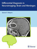 Differential Diagnosis in Neuroimaging: Spine