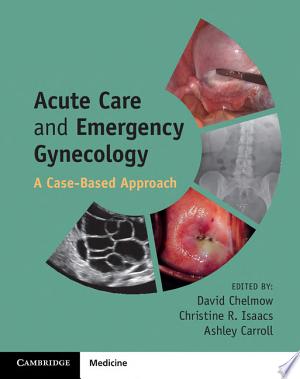 Acute Care and Emergency Gynecology: A Case-Based Approach