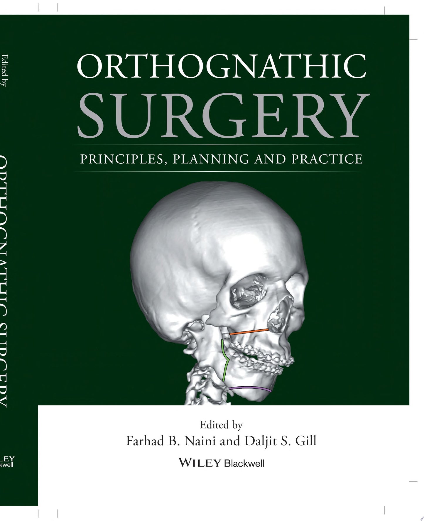 Orthognathic Surgery: Principles, Planning and Practice