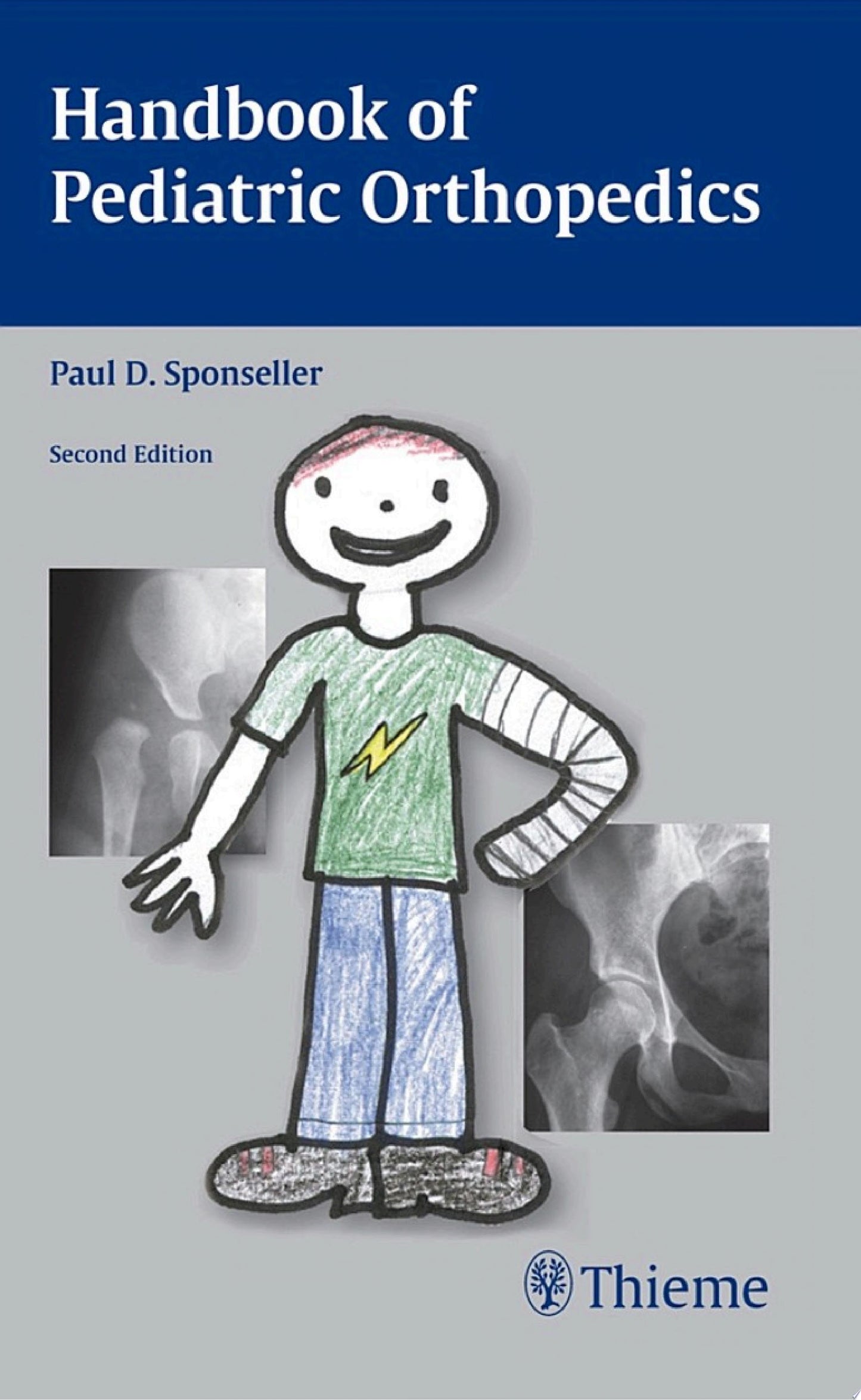 Handbook of Pediatric Orthopedics, 2nd Edition