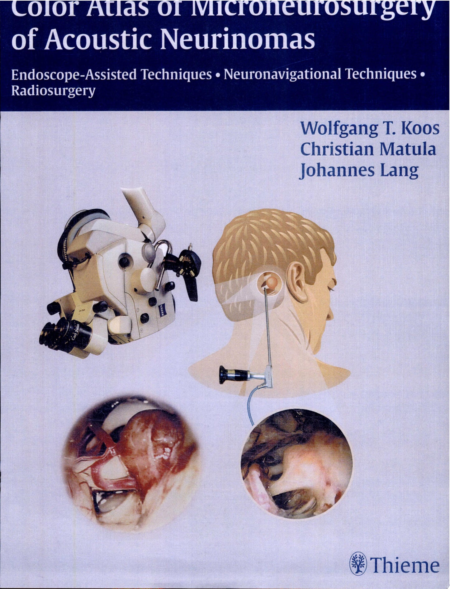 Color Atlas of Microneurosurgery of Acoustic Neurinomas