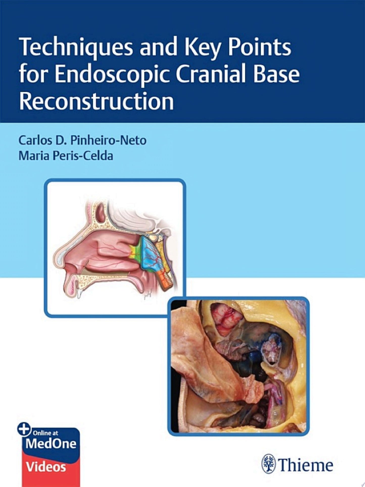 Techniques and Key Points for Endoscopic Cranial Base Reconstruction