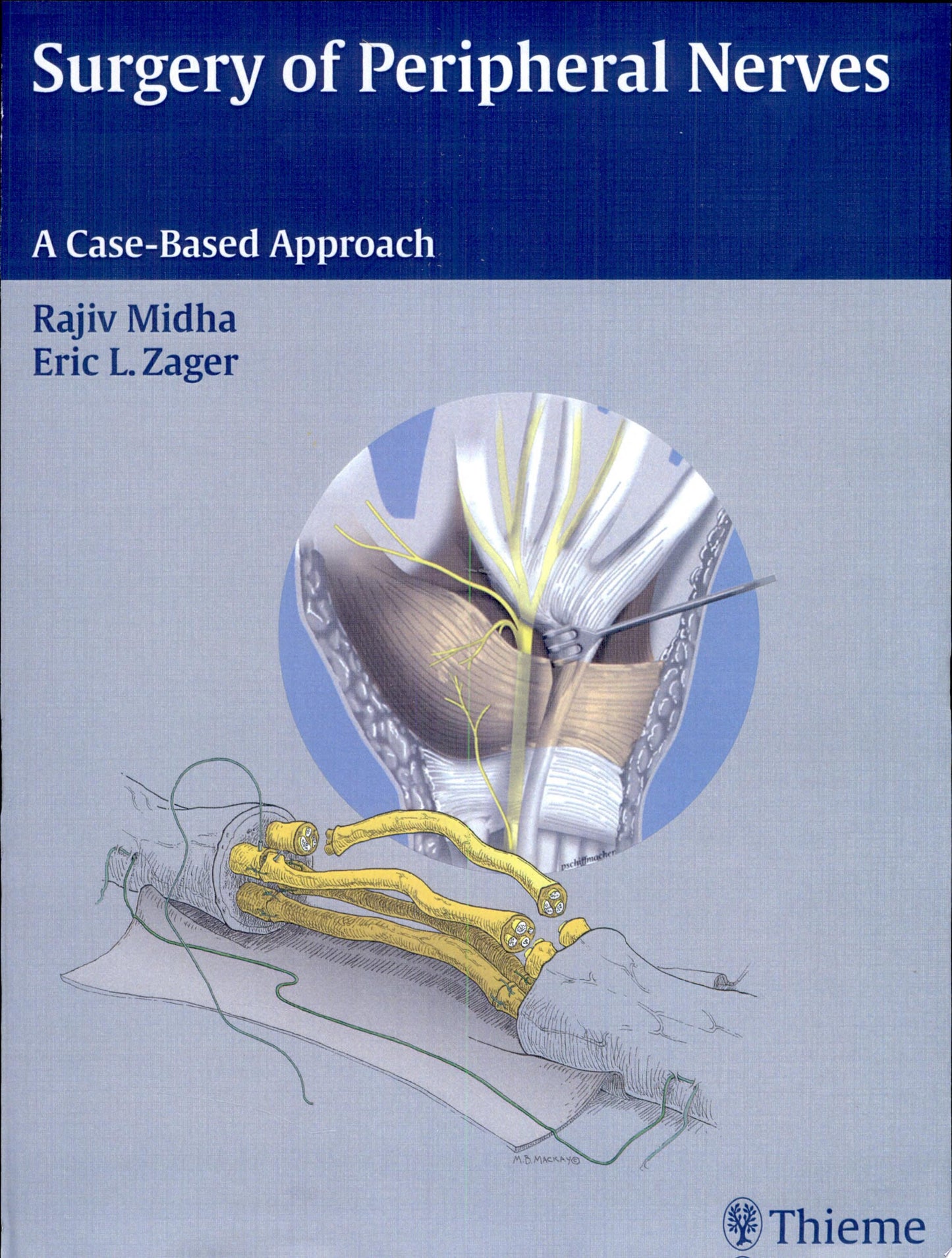 Surgery of Peripheral Nerves: A Case-Based Approach