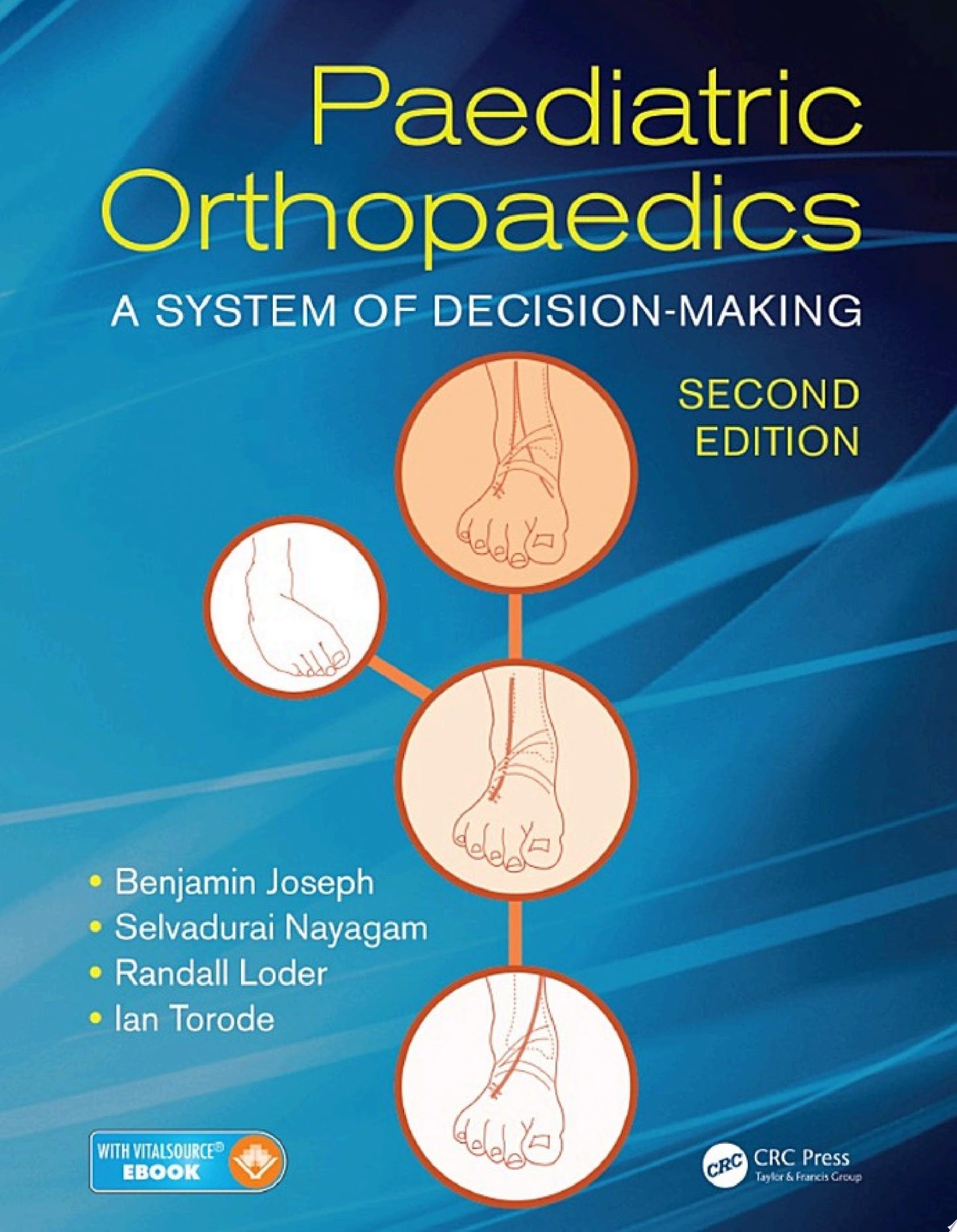Paediatric Orthopaedics: A System of Decision-Making, Second Edition