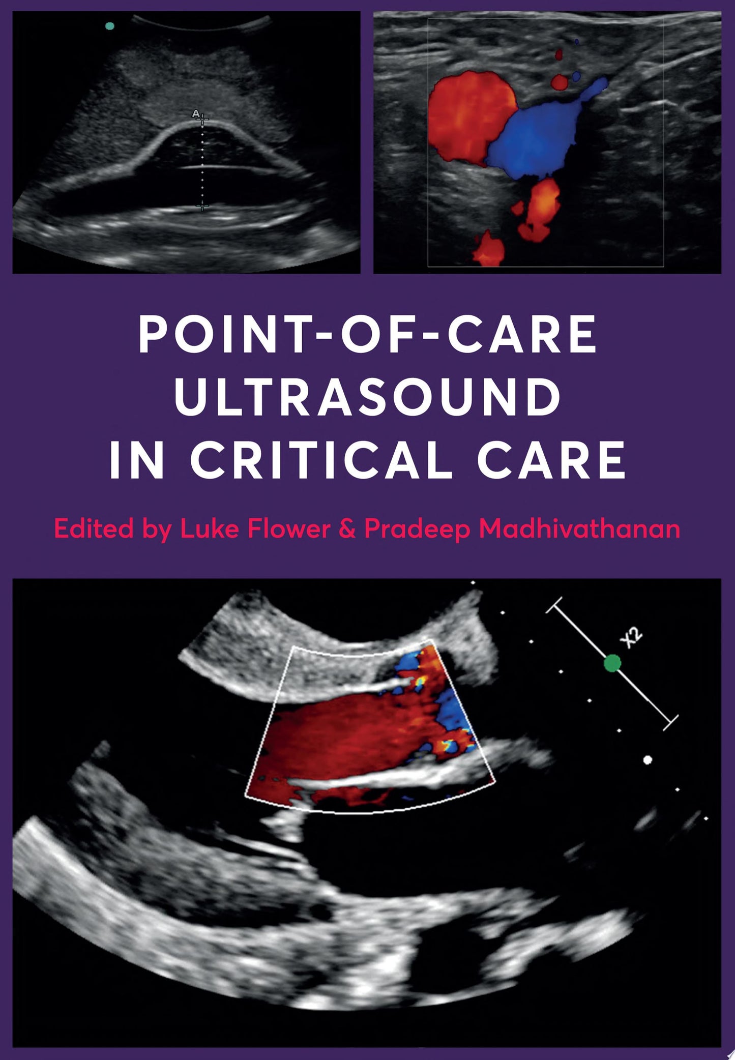 Point-of-Care Ultrasound in Critical Care