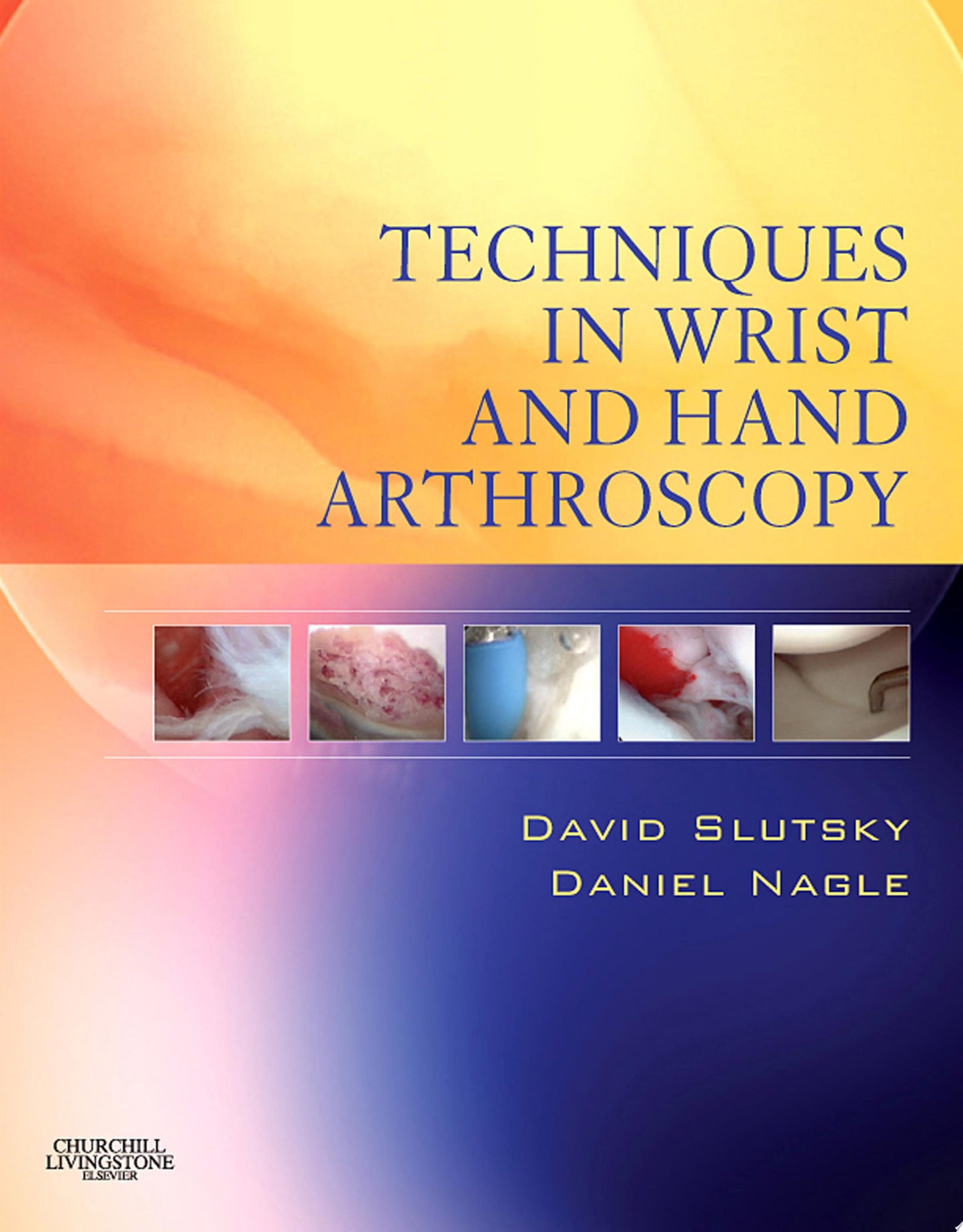 Techniques in Wrist and Hand Arthroscopy, 2nd Edition
