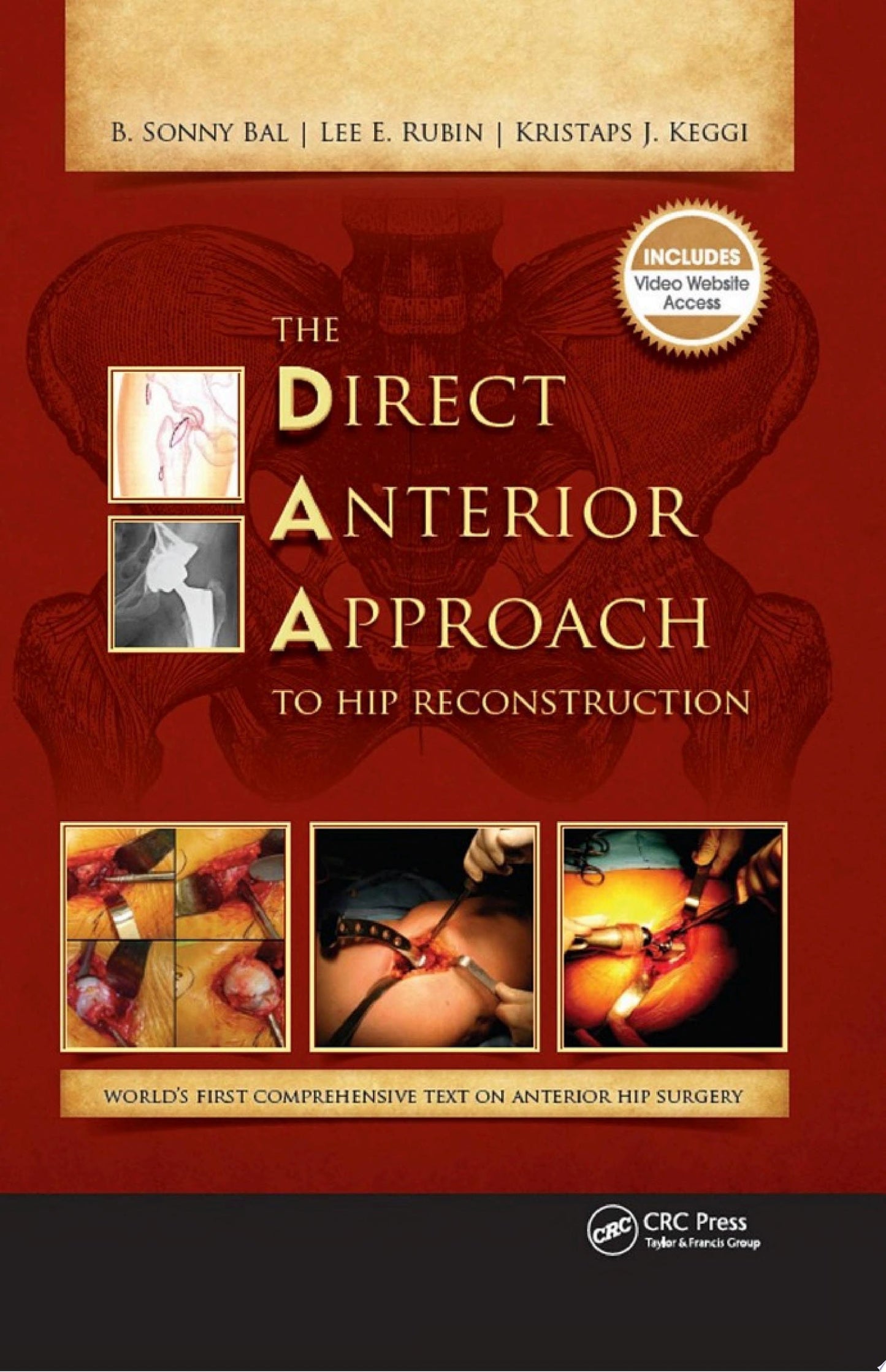 The Direct Anterior Approach to Hip Reconstruction, 2nd Edition