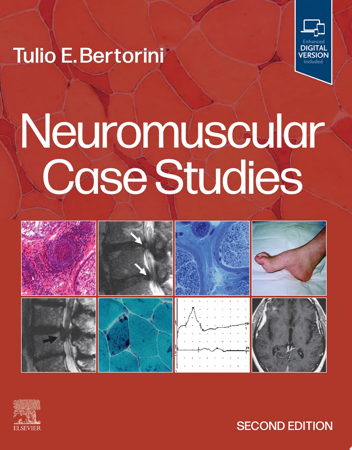 Neuromuscular Case Studies, 2nd Edition