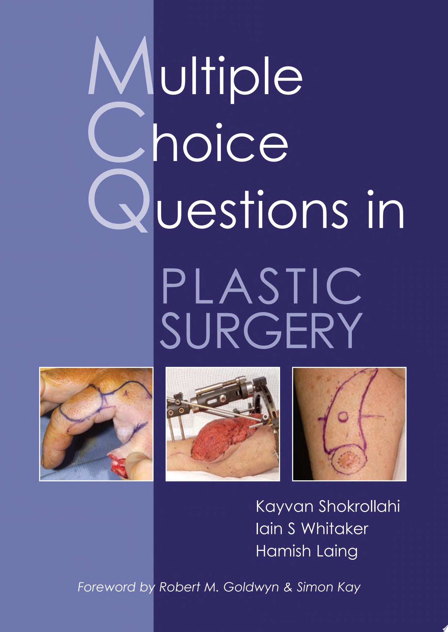 MCQs in Plastic Surgery