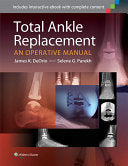 Total Ankle Replacement: An Operative Manual