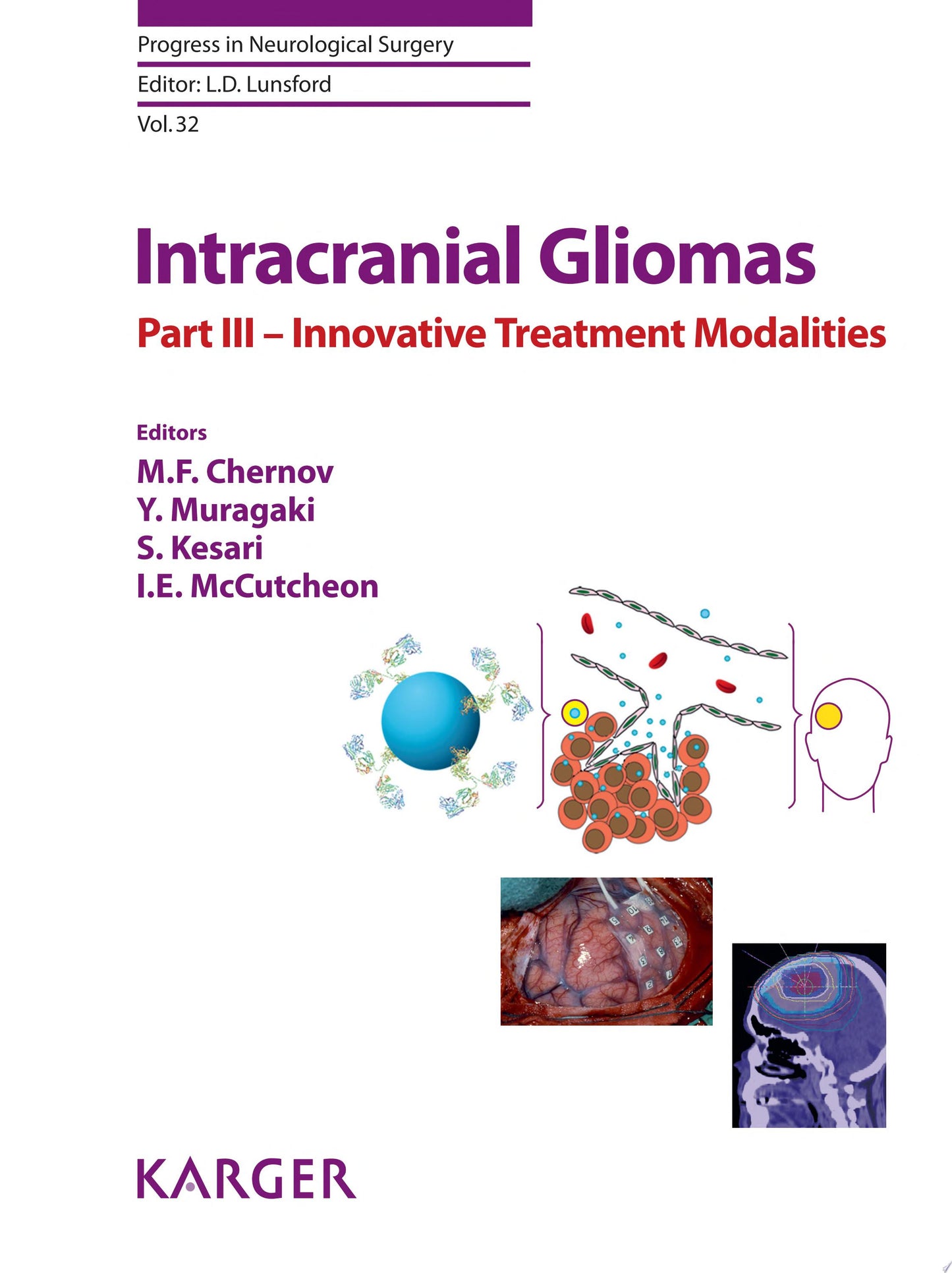 Intracranial Gliomas Part III – Innovative Treatment Modalities