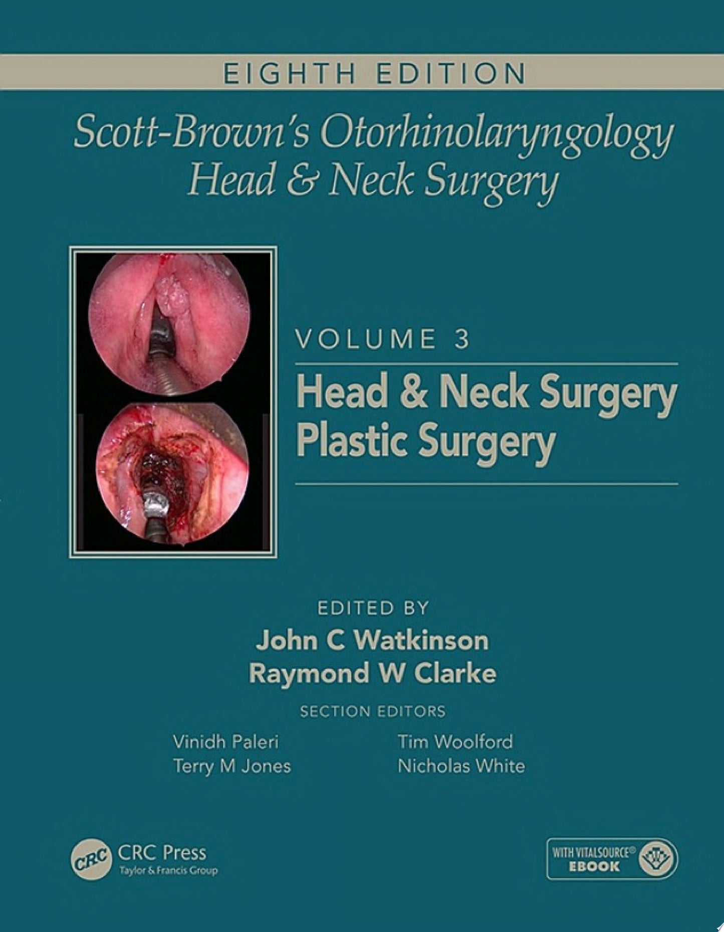 Scott-Brown’s Otorhinolaryngology and Head and Neck Surgery: Volume 3: Head and Neck Surgery, Plastic Surgery