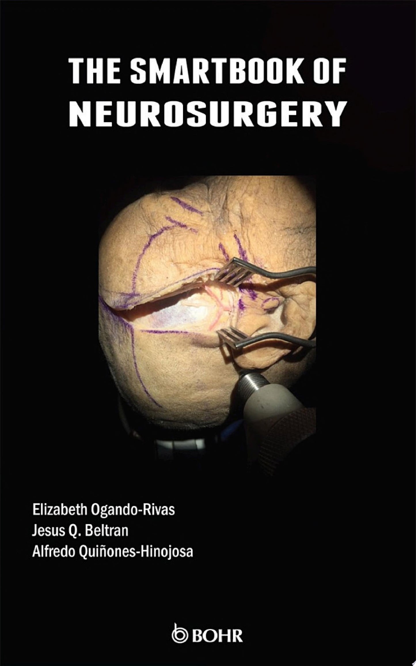 Manual of Peripheral Nerve Surgery: From the Basics to Complex Procedures, 1st edition