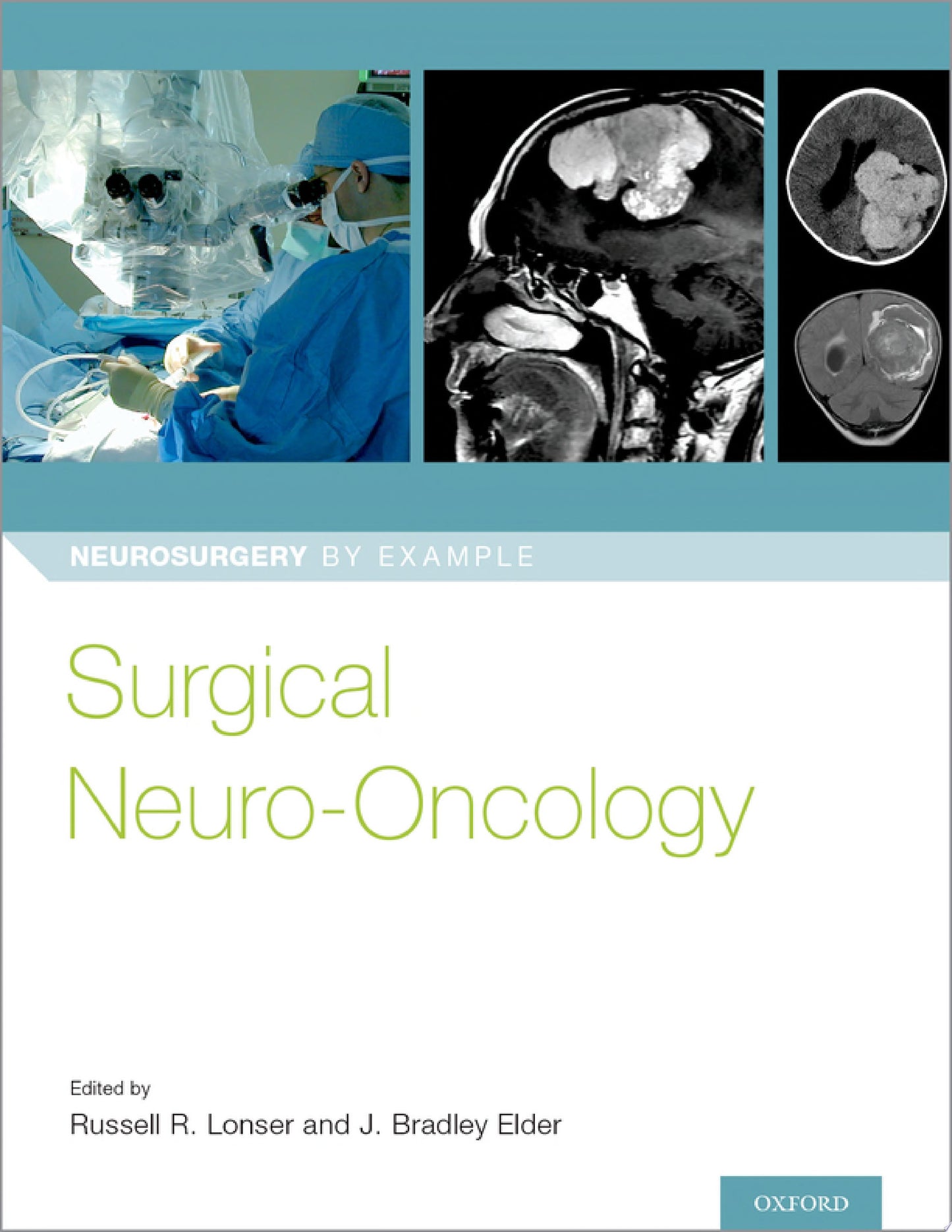 Surgical Neuro-Oncology