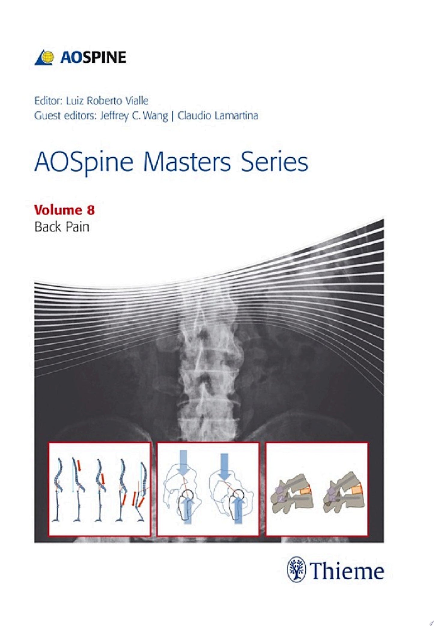 AOSpine Masters Series: Back Pain, Volume 8