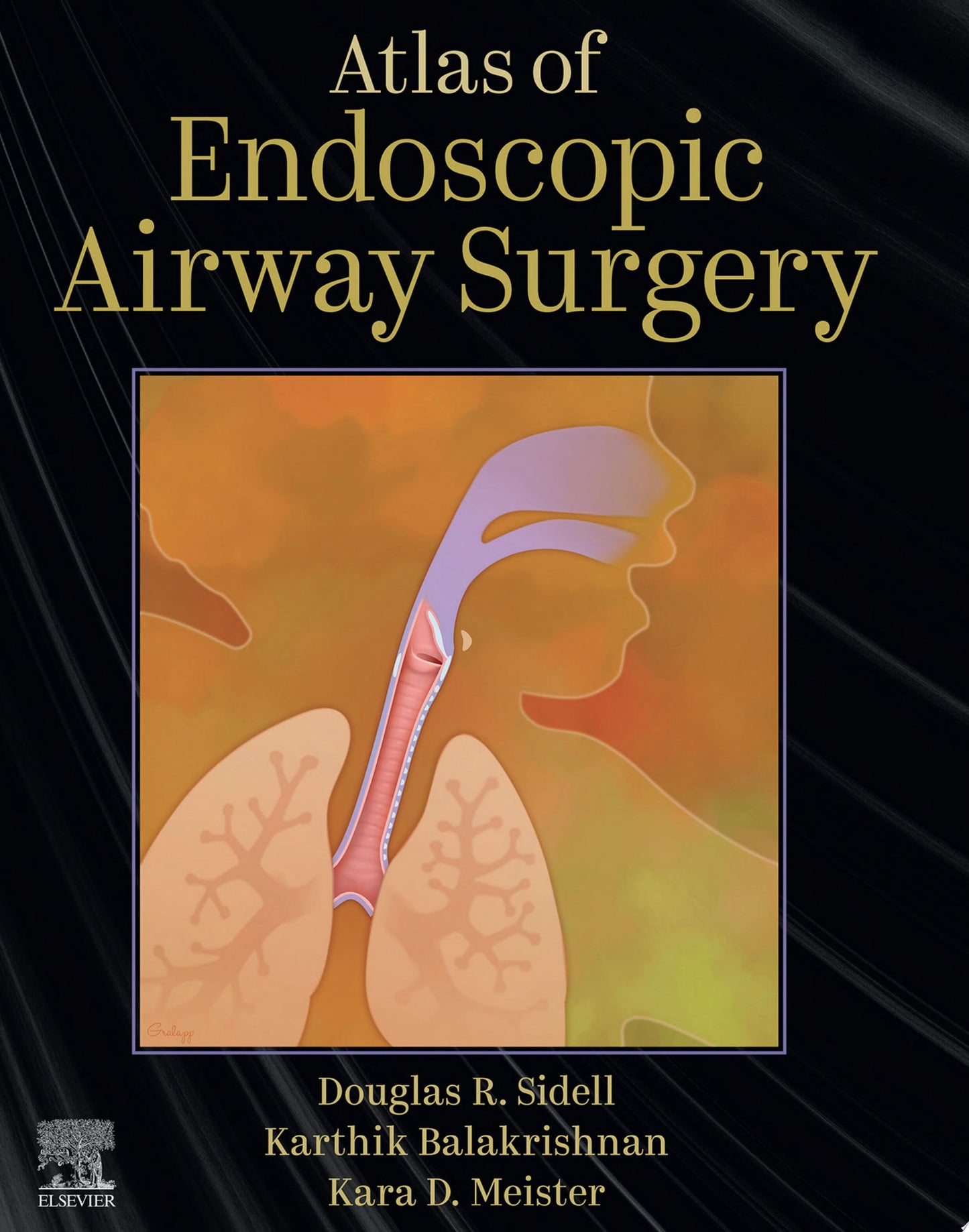 Atlas of Endoscopic Airway Surgery