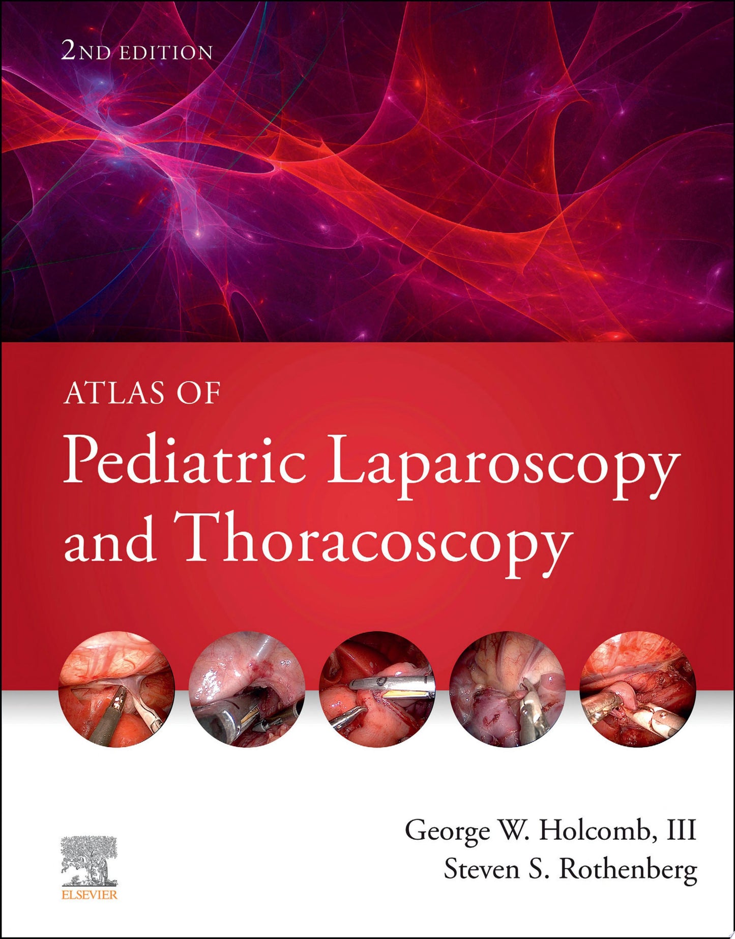 Atlas of Pediatric Laparoscopy and Thoracoscopy, 2nd edition