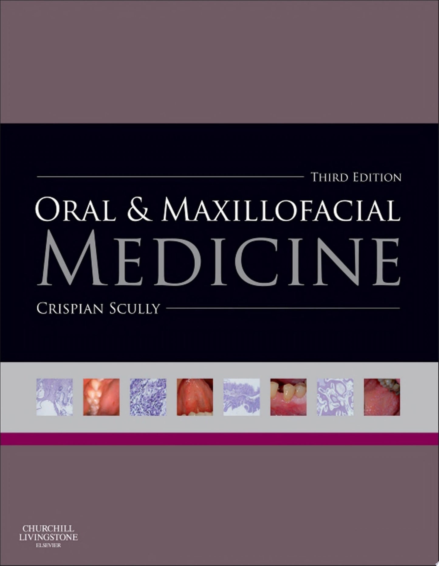 Oral and Maxillofacial Medicine: The Basis of Diagnosis and Treatment, 3rd Edition