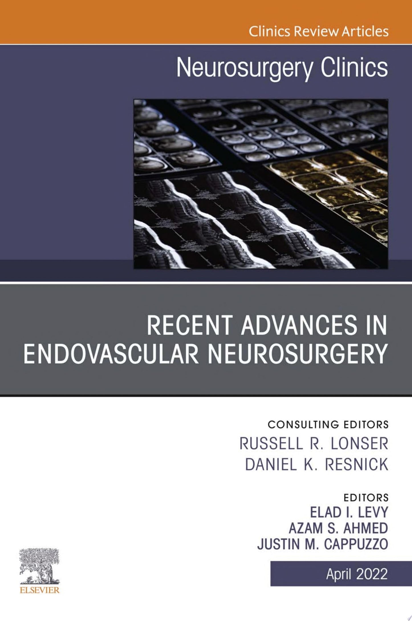 Recent Advances in Endovascular Neurosurgery, An Issue of Neurosurgery Clinics of North America, E-Book