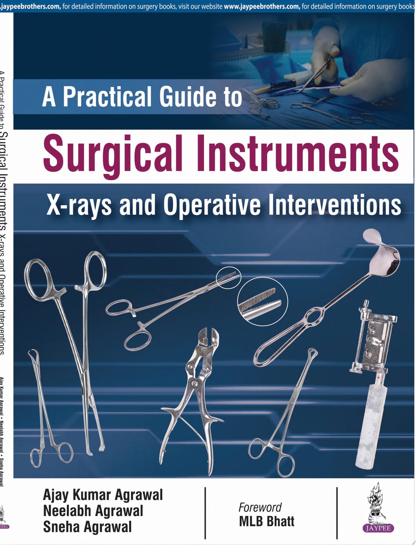 A Practical Guide to Surgical Instruments: X-Rays and Operative Interventions