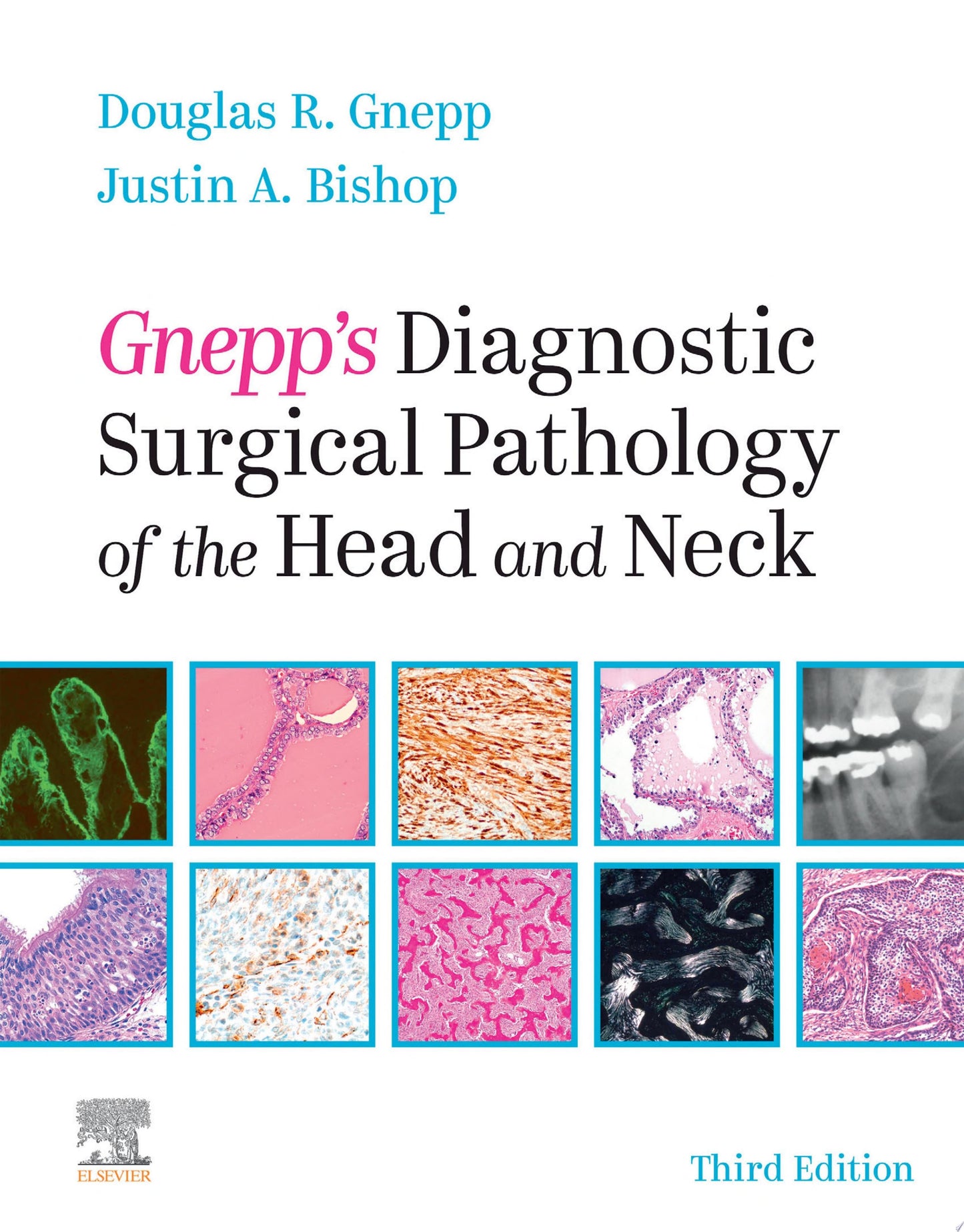 Gnepp's Diagnostic Surgical Pathology of the Head and Neck