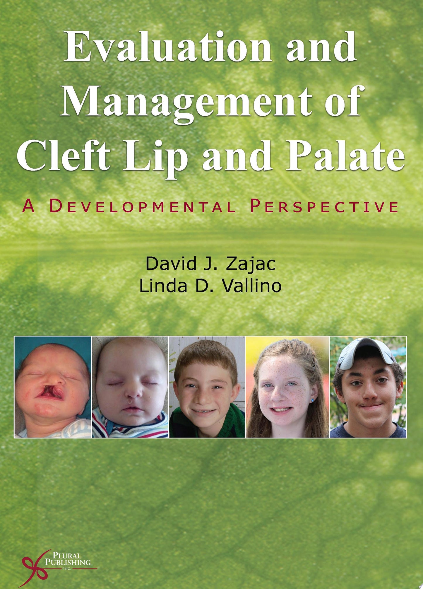 Evaluation and Management of Cleft Lip and Palate: A Developmental Perspective, 2nd Edition