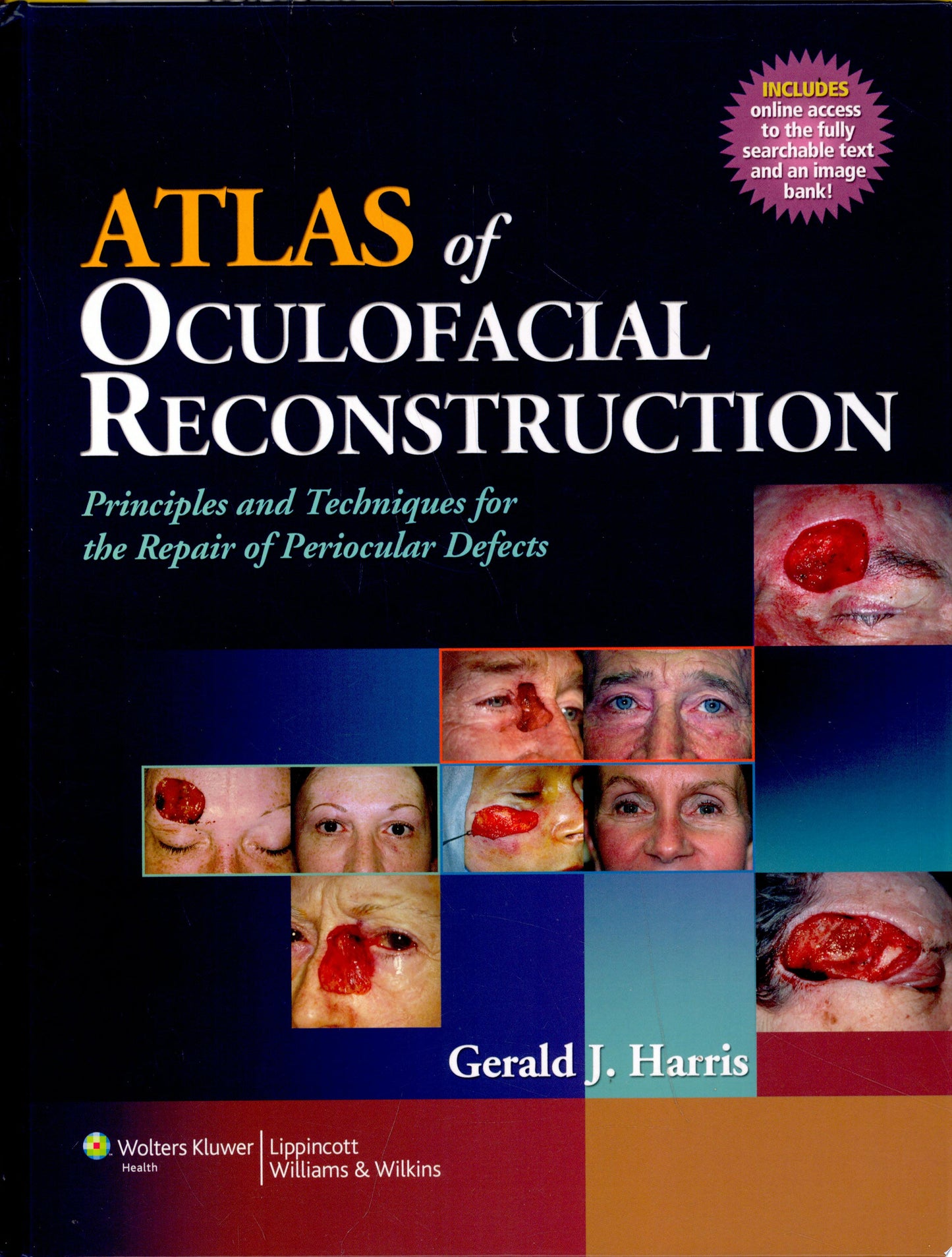 Atlas of Oculofacial Reconstruction: Principles and Techniques for the Repair of Periocular Defects