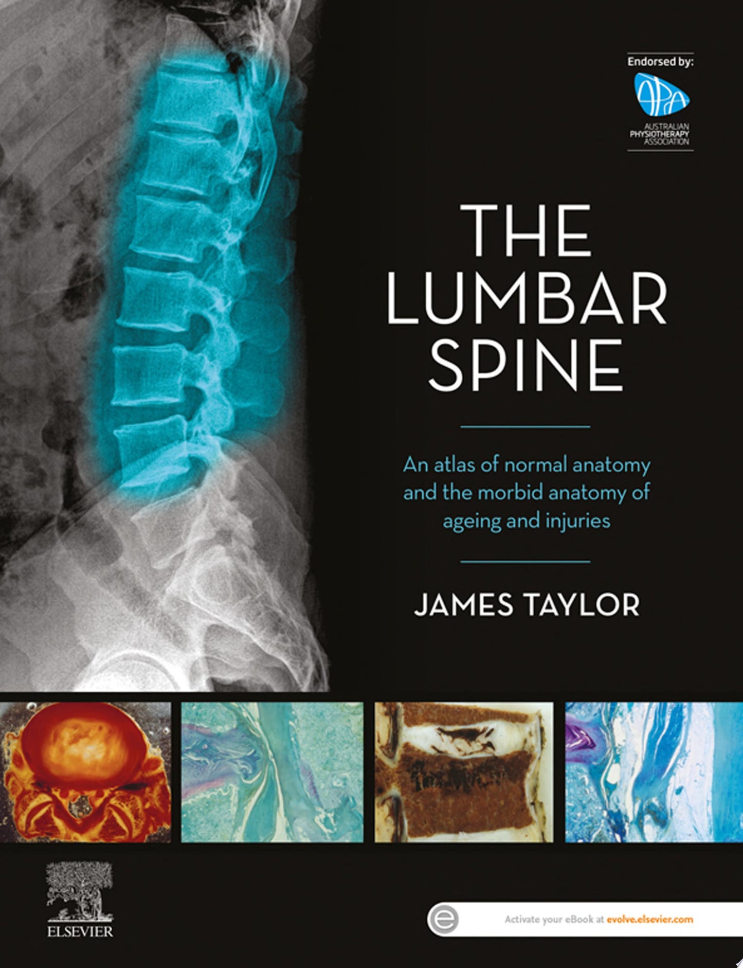 The Lumbar Spine: An Atlas of Normal Anatomy and the Morbid Anatomy of Ageing and Injury