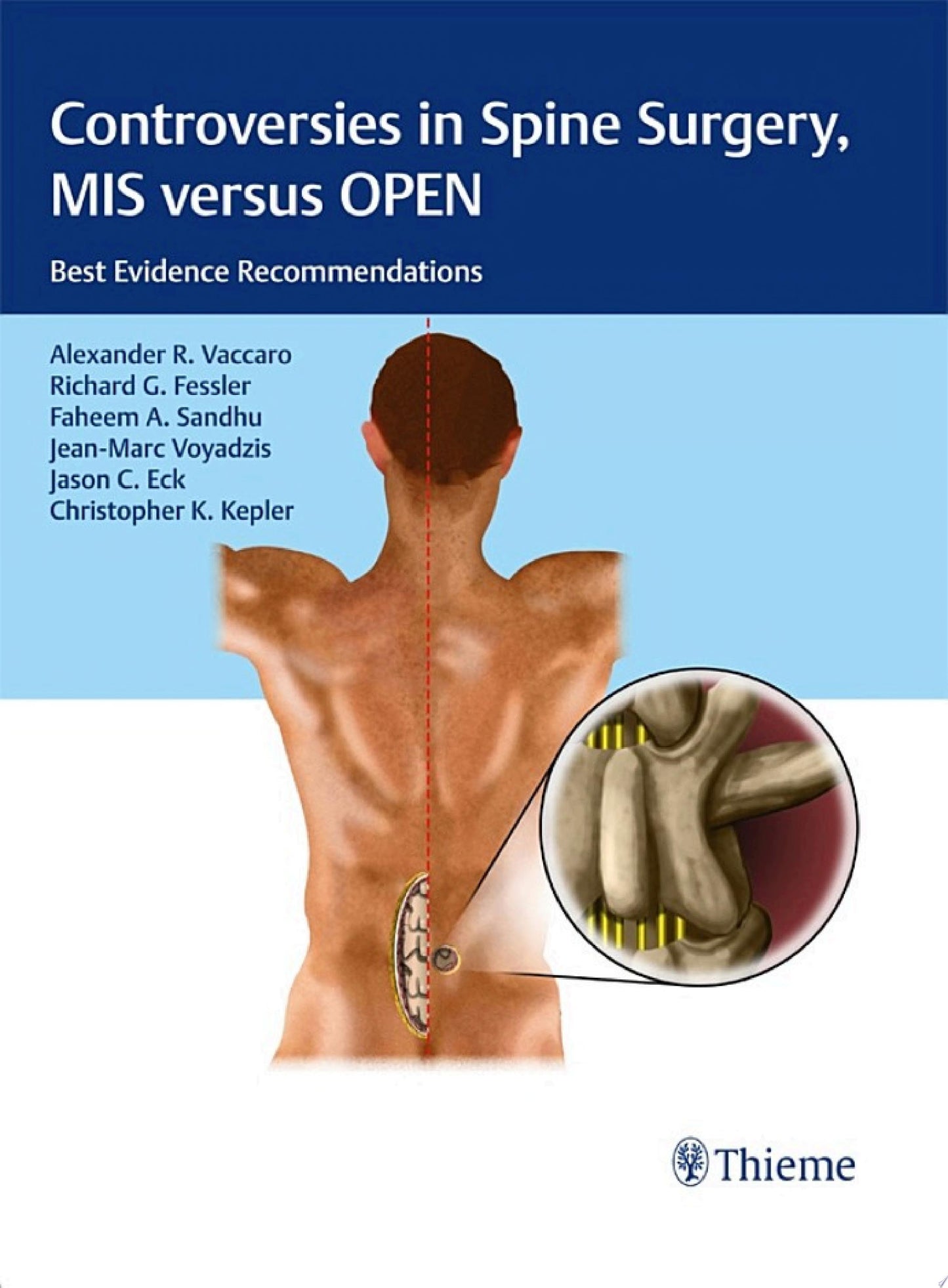Controversies in Spine Surgery