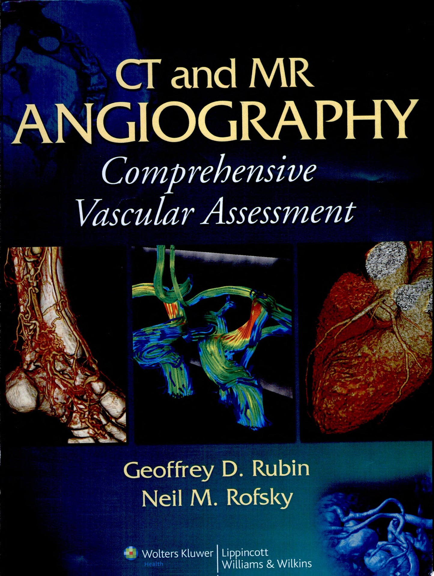 CT and MR Angiography: Comprehensive Vascular Assessment