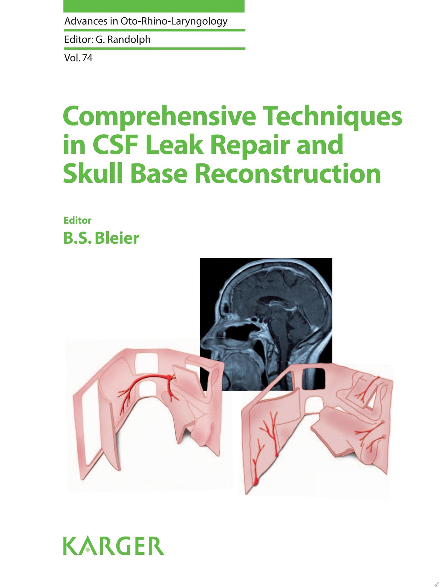 Comprehensive Techniques in CSF Leak Repair and Skull Base Reconstruction