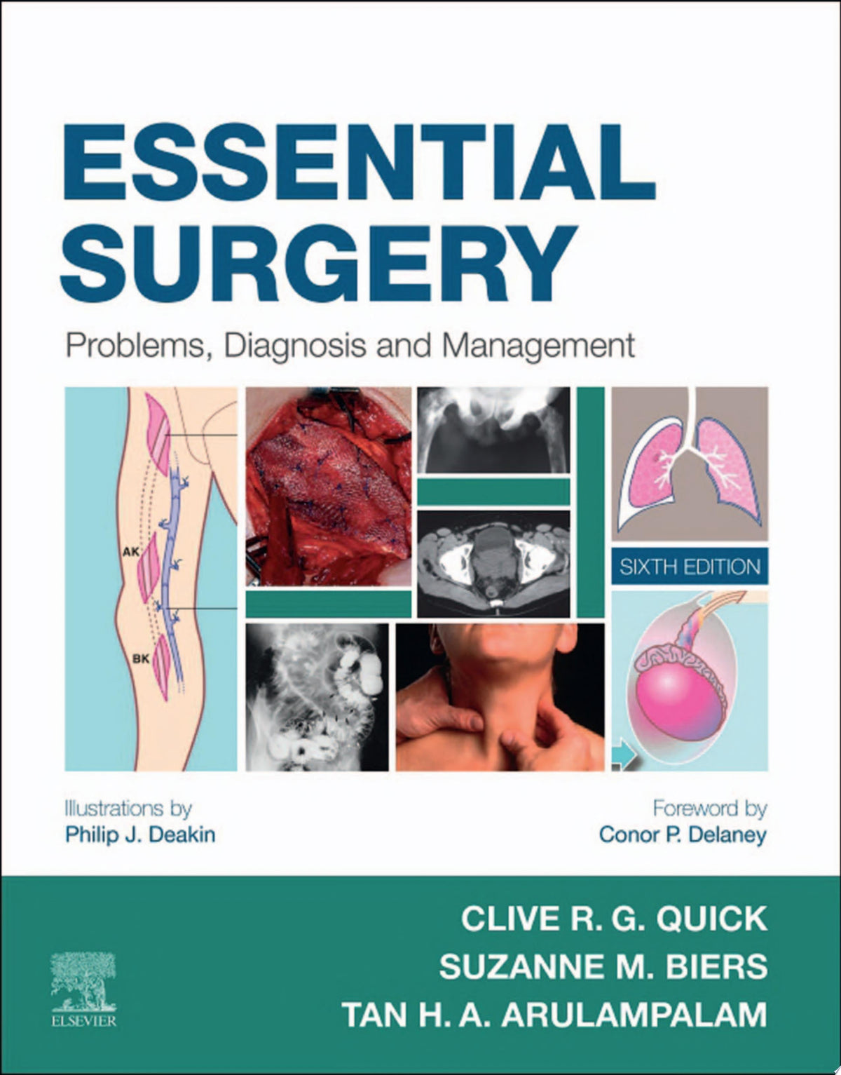 Essential Surgery: Problems, Diagnosis and Management, 6th Edition
