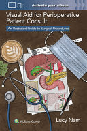 Visual Aid for Perioperative Patient Consult: An Illustrated Guide to Surgical Procedures