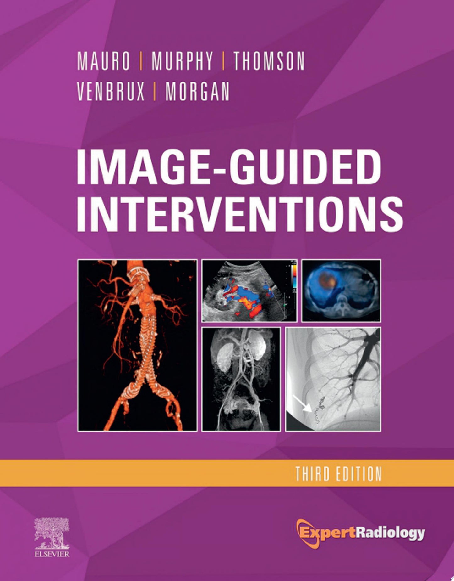 Image-Guided Interventions: Expert Radiology Series , 2e